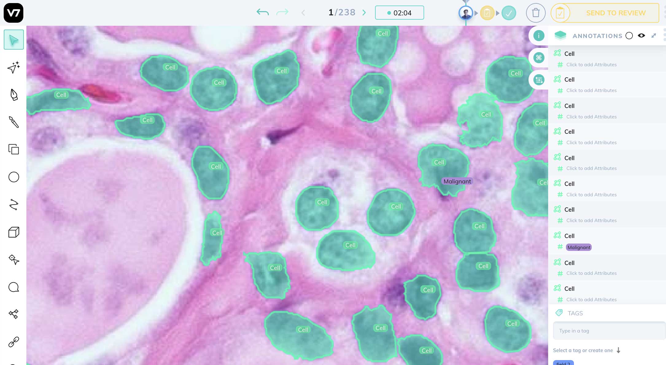 Artficial intelligence image annotation in digital pathology